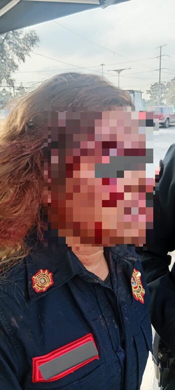 Una mujer policía resultó con