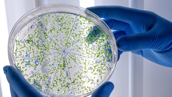 Crean una terapia con virus para atacar a una peligrosa bacteria que infecta los pulmones