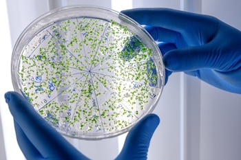 Un científico sostiene una placa de bacterias
