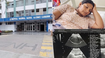 Fachada del Hospital Daniel Alcides Carrión, una mujer acostada en una cama clínica y una pantalla con ecografías obstétricas.