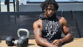 Nació con una malformación, pasó