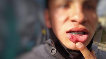 De acuerdo con informaciones de habitantes del sector se trató de un joven deportista del municipio. Vía: Twitter @TusDerechosA