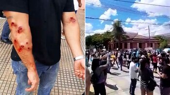 Graves incidentes y heridos en