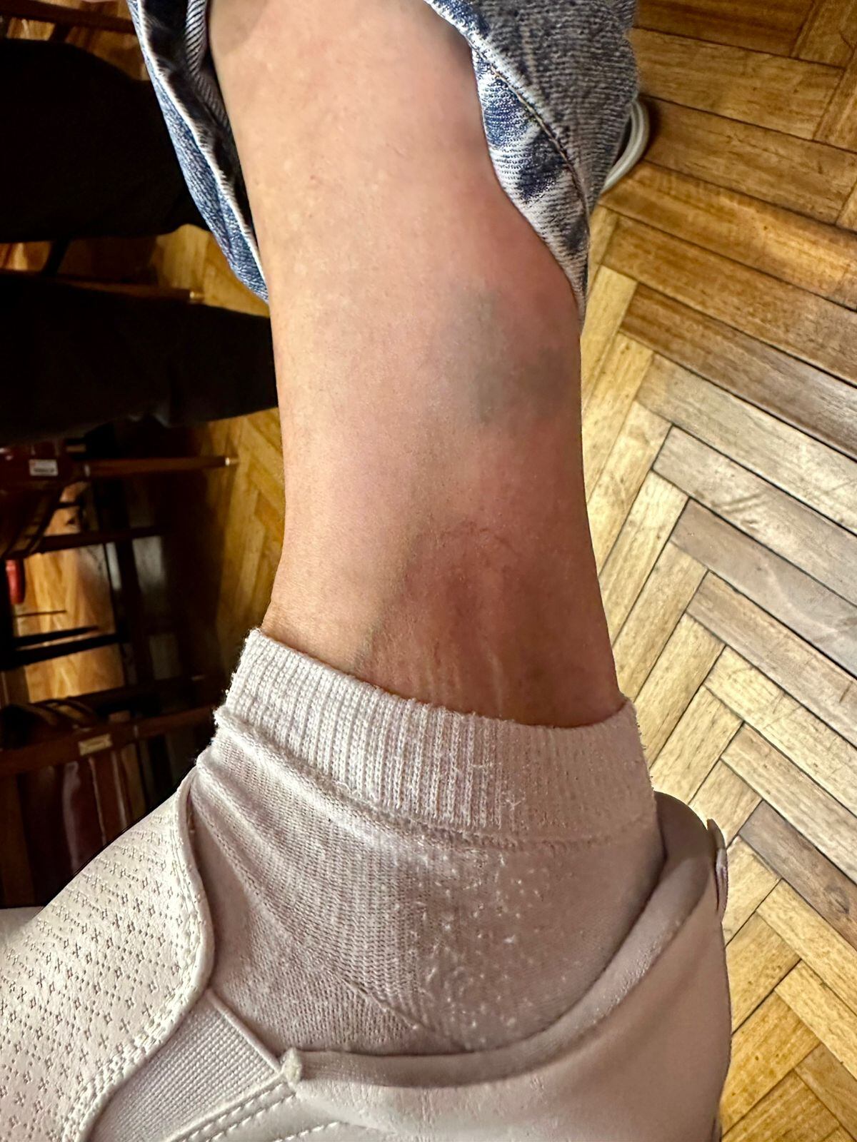 La senadora denunció que fue agredida en la pierna derecha