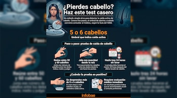 Infografía en tonos azules que muestra una mujer preocupada por la caída del cabello, pasos para un test casero de tracción capilar, un calendario y un icono médico de recomendación.