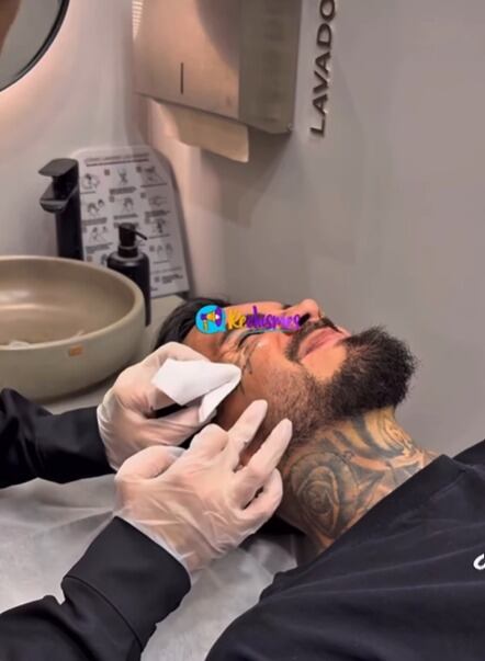 Así inició Mateo Carvajal proceso de remover sus tatuajes de la cara - crédito @rechismes/IG