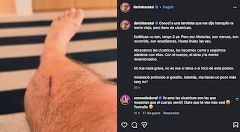 El conductor compartió una foto de su pierna herida y habló sobre el valor de las marcas, el aprendizaje y el paso del tiempo
