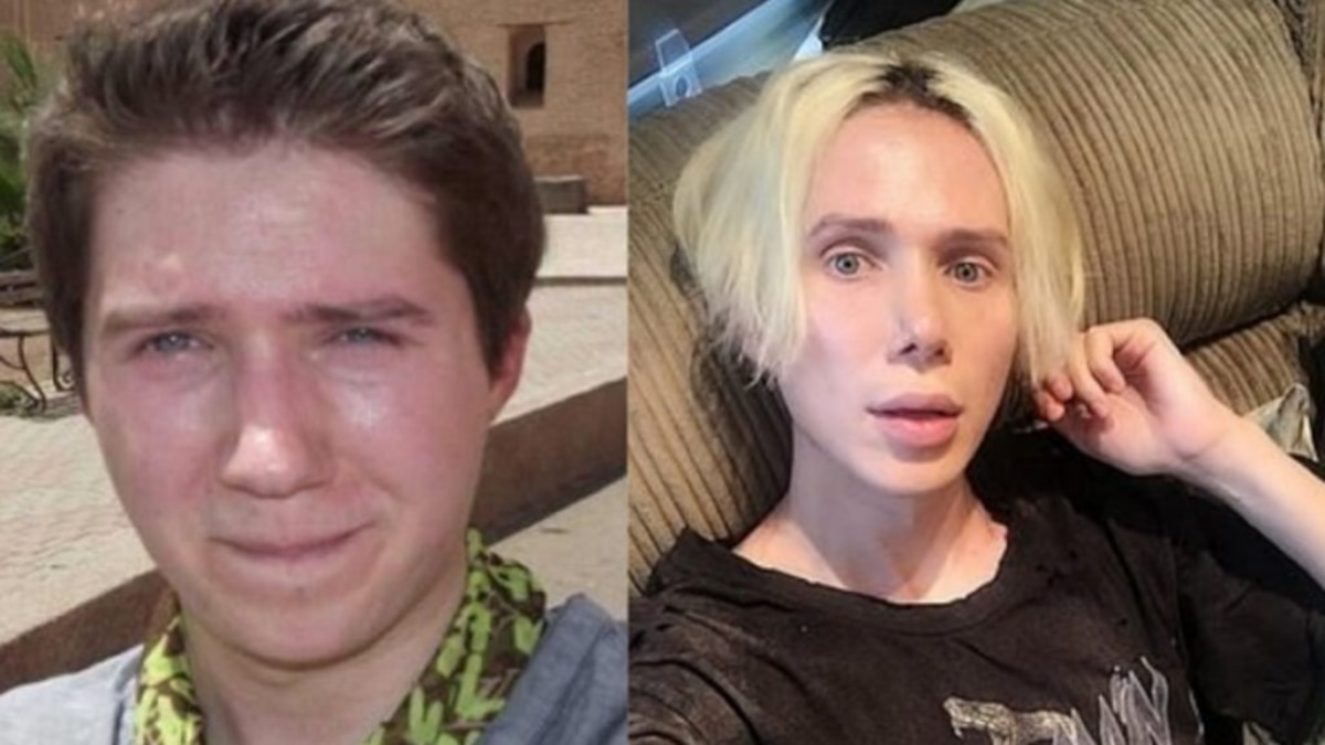 La insólita polémica sobre la “transracialidad” desatada por un youtuber que se realizó 18 cirugías y se declaró coreano - Infobae