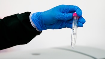 Un experimento con ranas alerta