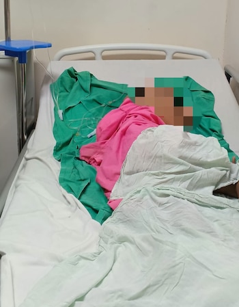 Los médicos diagnosticaron una apendicitis perforada dos días después de la primera consulta en el hospital. (Cortesía: Redes sociales)