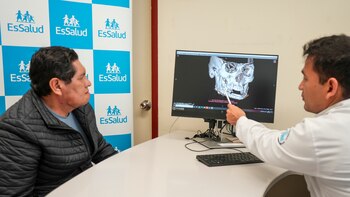 Hombre recupera su mandíbula tras