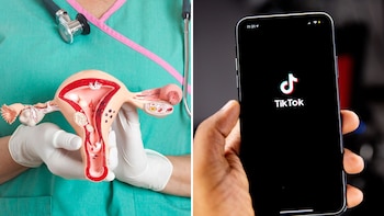 El cáncer de ovario (Getty