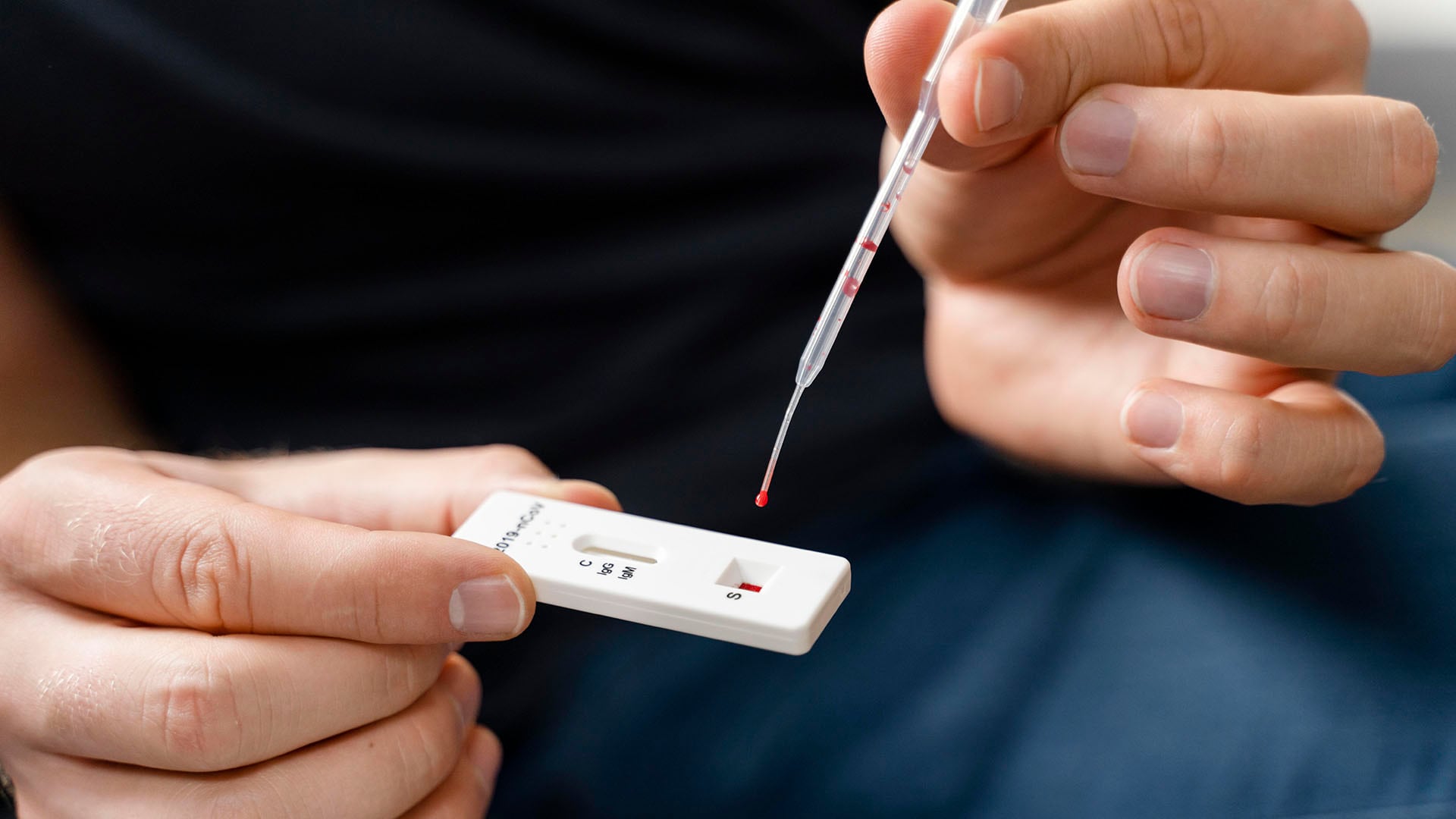 Para saber si una persona tiene inmunidad frente al sarampión, se deben acreditar dos dosis de la vacuna triple viral aplicadas después del primer año de vida o contar con un análisis de sangre que confirme la presencia de anticuerpos IgG contra el virus (Freepik)