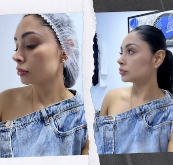 Pamela Franco sorprendió al someterse