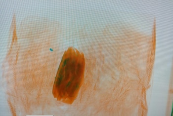 Mediante un escáner, los efectivos