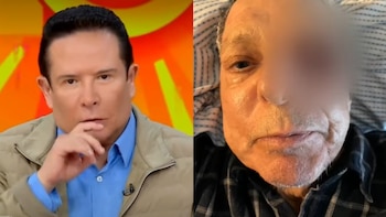 Gustavo Adolfo Infante se disculpa por difundir erróneamente que César Bono perdió un ojo