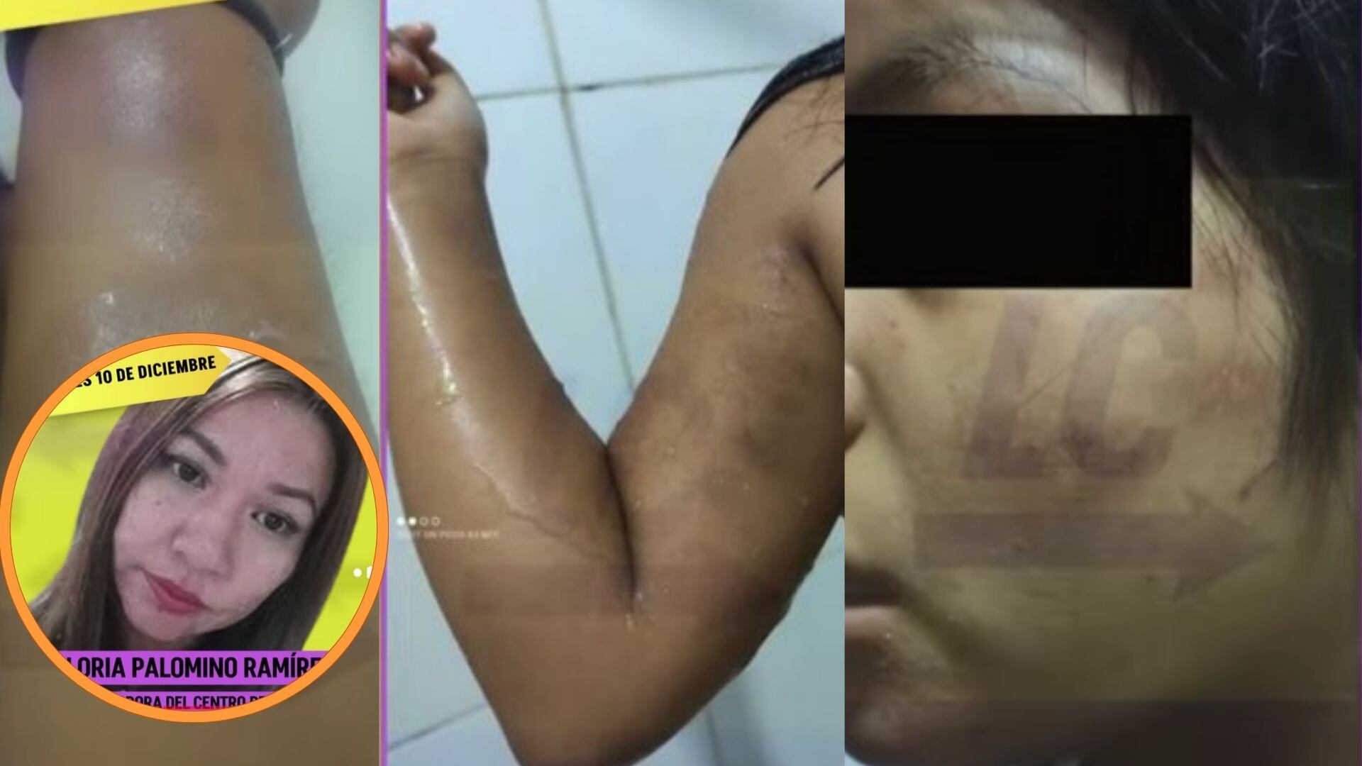 Denuncian maltratos a niñas del CAR Niño Jesús de Praga, albergue del Inabif, en Pueblo Libre | Foto captura: La Contra