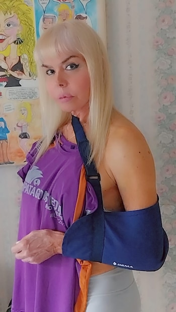 Adriana Aguirre en su casa, con el cabestrillo por su lesión