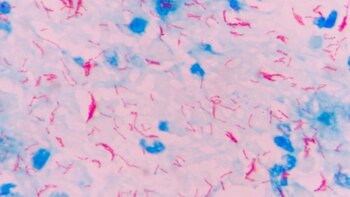 La Mycobacterium tuberculosis es uno
