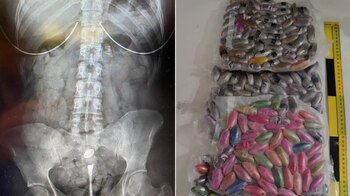 Bellotas de cocaína que llevaba