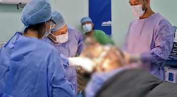 La técnica consiste en implantar un electrodo cerebral conectado a un dispositivo bajo la clavícula que regula el movimiento. (CSS)