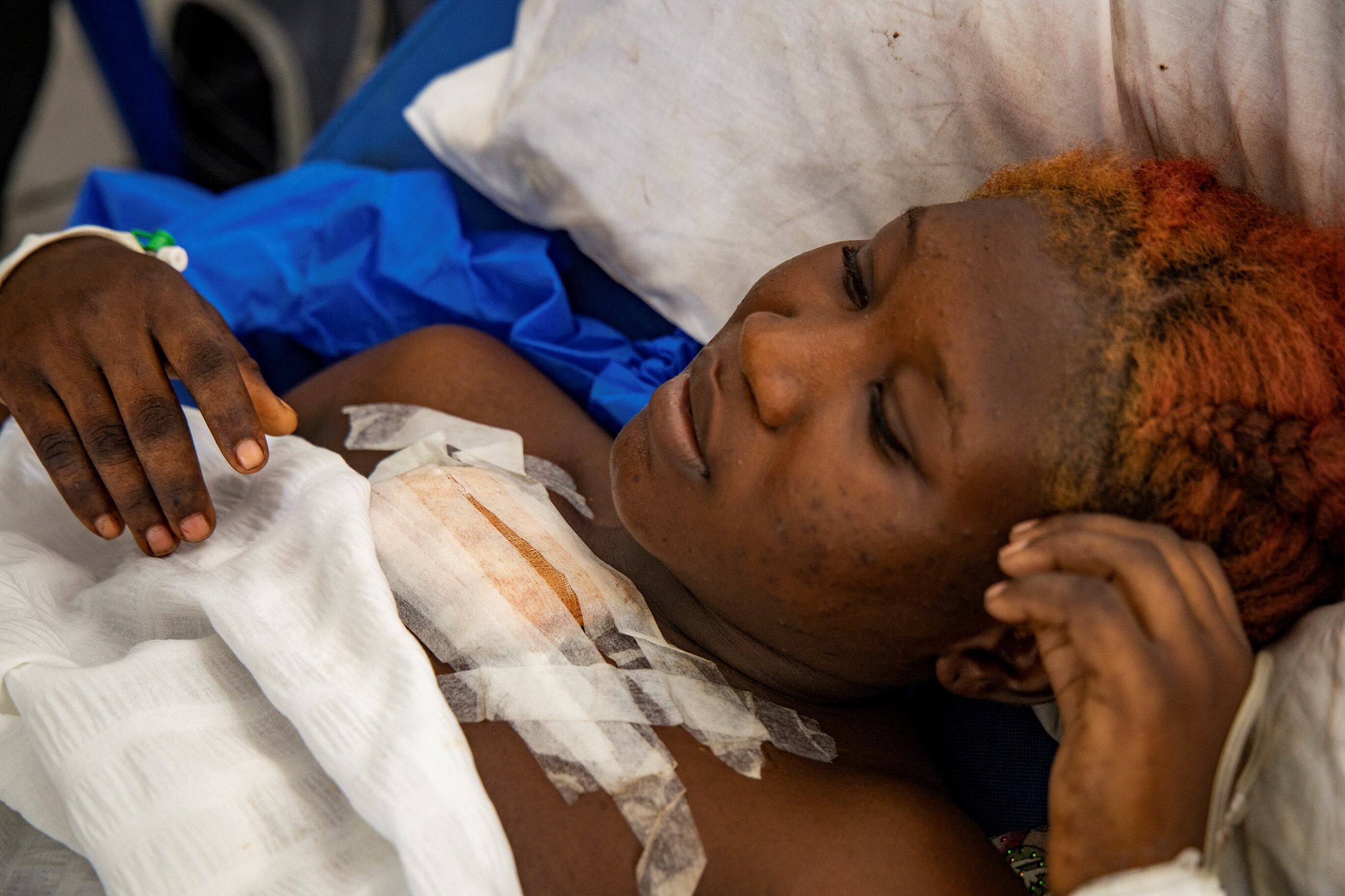 Una mujer herida en un ataque mortal perpetrado por miembros de la pandilla Gran Grif, que arrasó la ciudad de Pont-Sondé y mató a varias personas, descansa en el Hospital Saint Nicolas en Saint-Marc, Artibonite, Haití. (REUTERS/Marckinson Pierre)