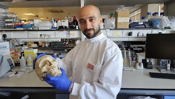 Hombre calvo con barba, bata blanca y guantes azules, sostiene un modelo de cráneo en un laboratorio con equipos y botellas