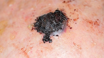 Menos es más para la