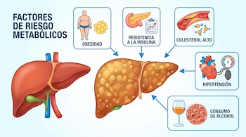 Hígados humano sano y con grasa. Íconos de obesidad, resistencia a la insulina, colesterol alto, hipertensión y consumo de alcohol.