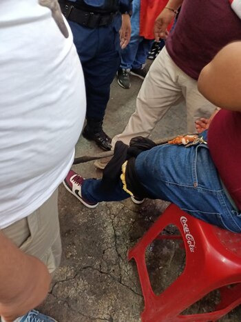 Un hombre fue baleado a