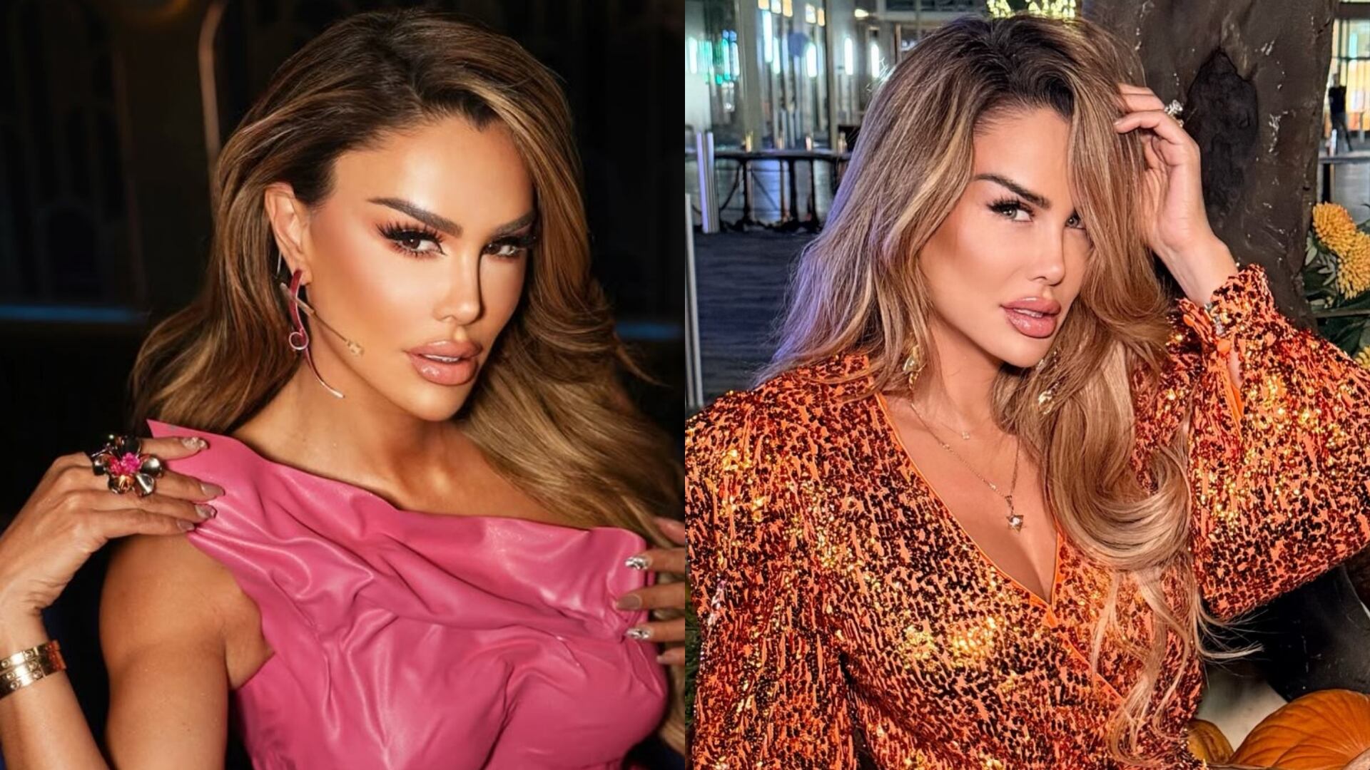 El costo de la cirugía para cambiar el color de ojos ha disminuido, pasando de USD 20.000 a USD 12.000, según Gustavo Adolfo Infante (IG)