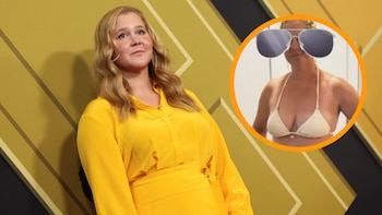 Amy Schumer comparte una imagen en bikini y destaca su cicatriz de cesárea: “Soy una guerrera”