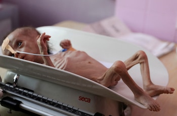 Un niño de seis meses,