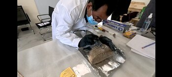 Toma de muestras de esmalte