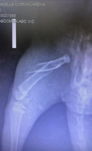 La ardilla sufrió una fractura