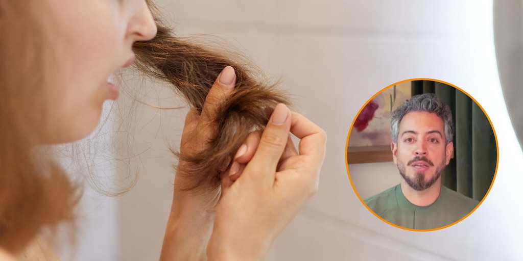 Los tres nutrientes clave para evitar la caída de pelo en mujeres: "Cuando a tu cuerpo le faltan, el cabello nunca va a ser su prioridad