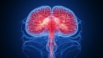 La enfermedad de Parkinson es