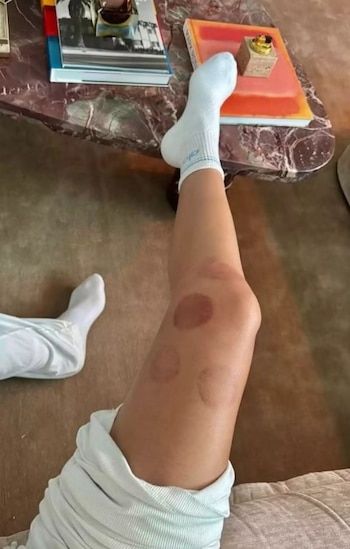 La modelo enfrenta molestias y