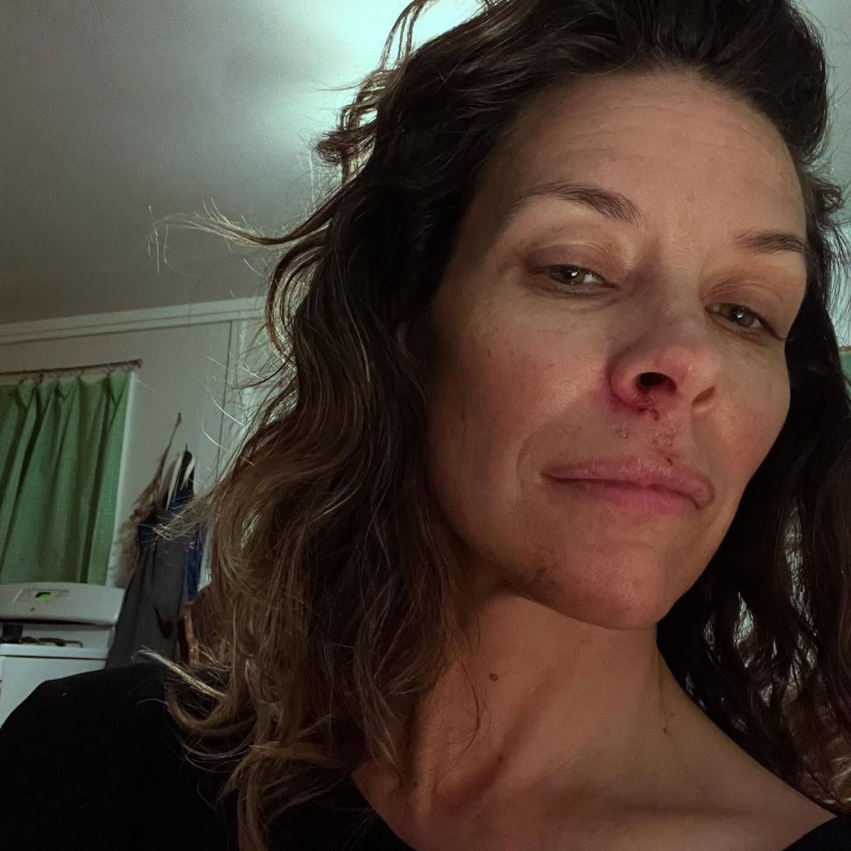 La actriz compartió en redes sociales que casi todas las áreas de su cerebro funcionan a menor capacidad según sus estudios médicos (Instagram/@evangelinelillyofficial)