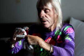Alain Robert se cubre las