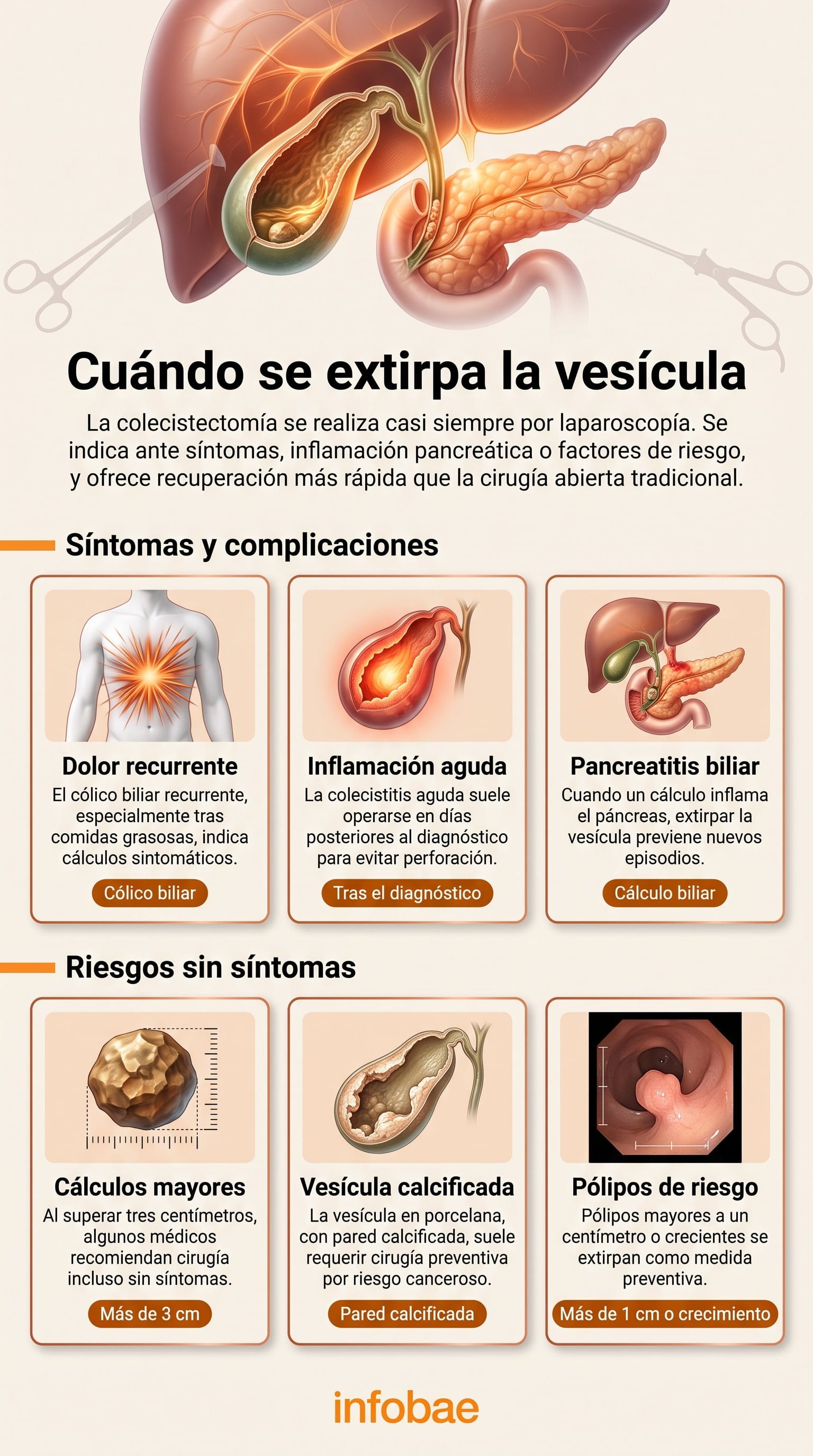 Una infografía de Infobae detalla las causas sintomáticas y los factores de riesgo asintomáticos que requieren una colecistectomía. (Imagen Ilustrativa Infobae)