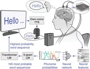 Se registran señales neuronales de la corteza motora del habla mediante cuatro matrices «Utah» de 64 electrodos mientras el participante intenta hablar (Universidad de California, Nature Medicine)