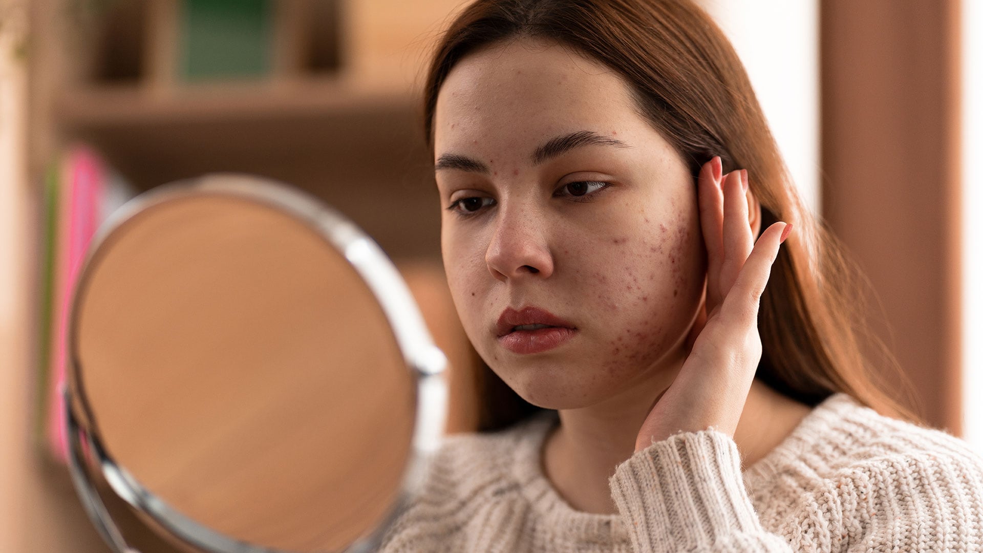 La dermatitis de contacto irritativa figuró como la afección más frecuente entre las personas afectadas por seguir tendencias virales de cuidado facial. (Freepik)