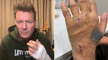 El músico Javier Malosetti sufrió un duro accidente que le impide tocar y contó cómo es su rehabilitación: “Días tristes”