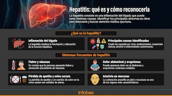 ¿Qué es la hepatitis y cuáles son sus principales síntomas?