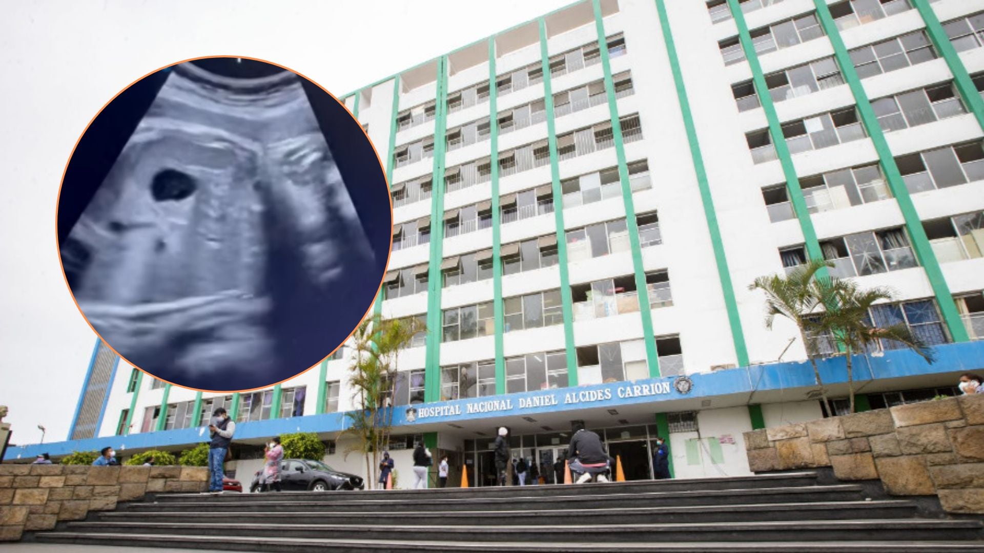Madre que esperaba gemelas acude al hospital Carrión, pero solo le entregaron a una y el médico se va de viaje