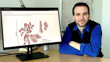 La IA que detecta bacterias peligrosas antes del primer contagio