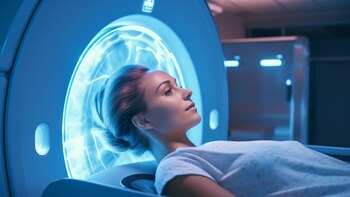 Neuromielitis óptica: cuáles son los