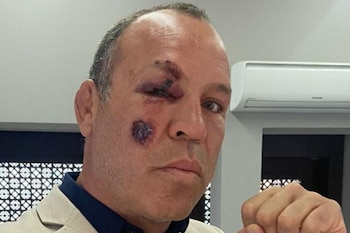 Accidente de Wanderlei Silva ex UFC
