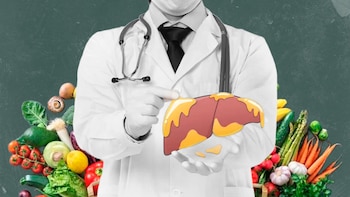Esteatosis hepática: cómo revertirlo, qué
